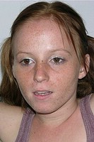Nude Amateur Freckled Face Teen